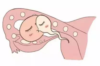 代生包成功代妈补偿